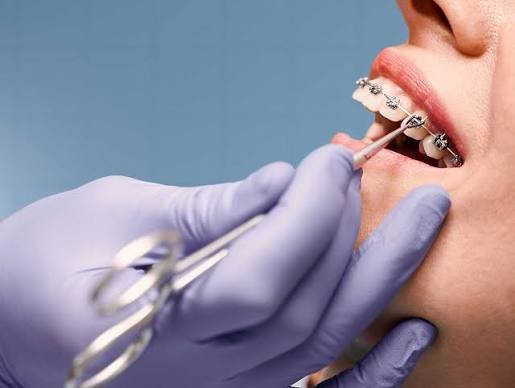 Blog — Annjana Dental Clinic